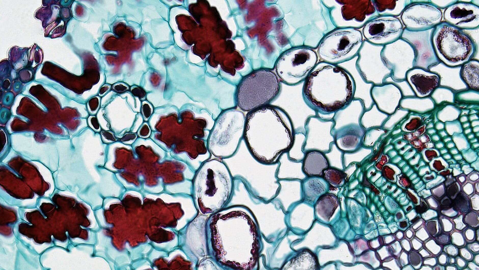 cell seen under microscope